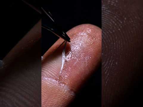 Skin peeling Macro Closeup _ Relaxing Vibe of asmr sounds . #shorts #satisfying #glue
