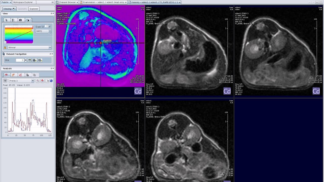 Using the ICON™ Powerful MRI, Simplified.