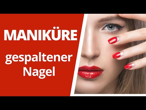 Gribok die Füsse mkb Die Verdickung des Nagels auf dem Daumen des Beines des Fotos und die Behandlung