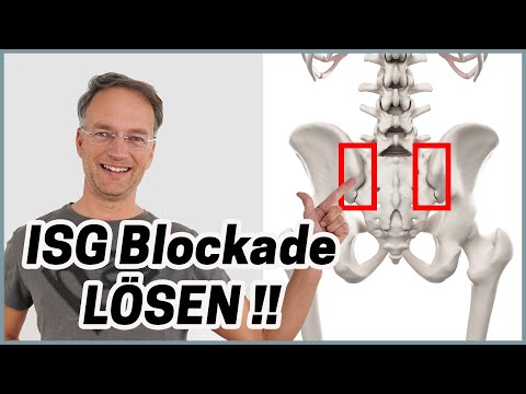 ISG Blockade SOFORT lösen (nur eine Übung notwendig)