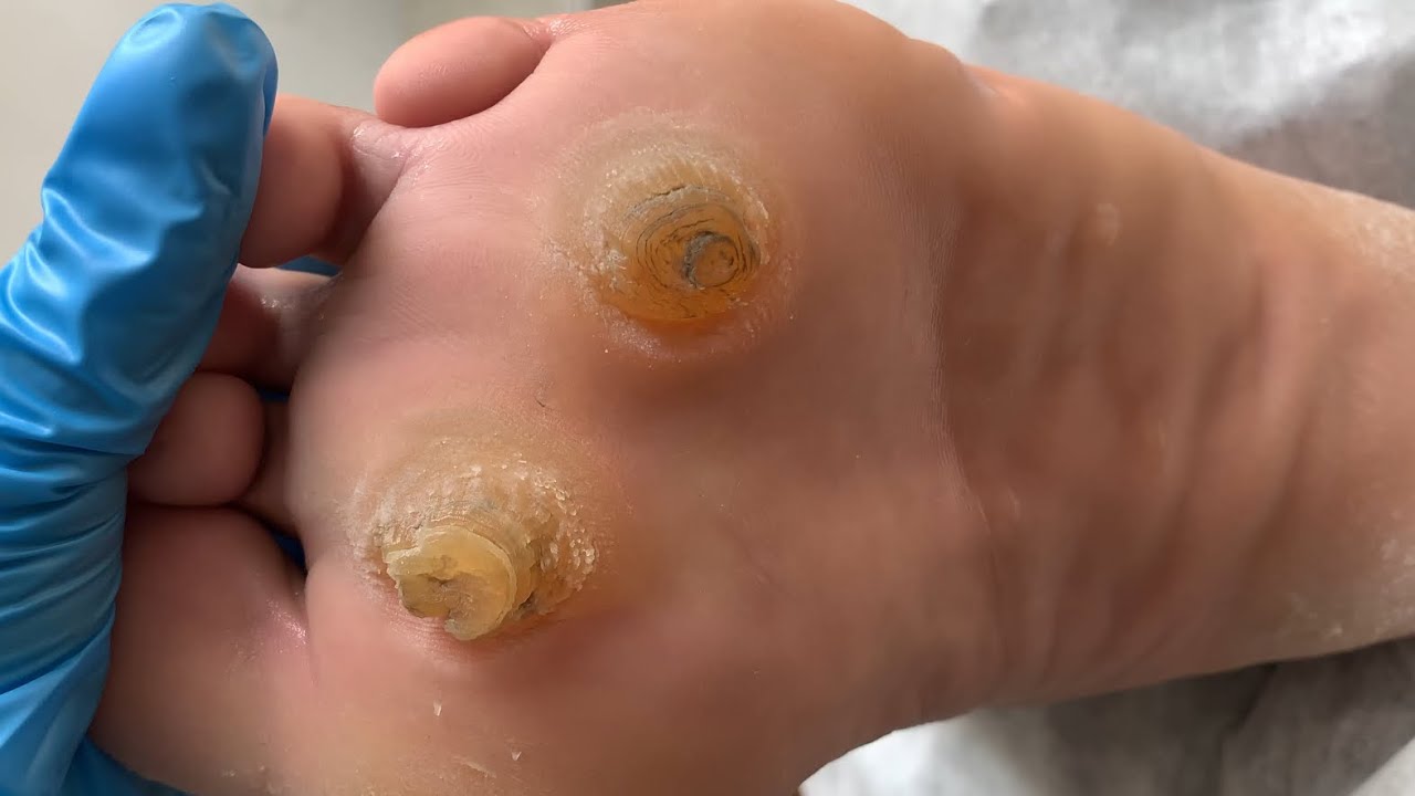 YouTube Thumbnail Downloader FULL HQ IMAGE