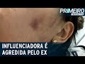 Influenciadora Digital Acusa Ex Namorado De Agressão Primeiro Impacto 13 07 21
