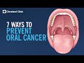 7 Ways to Prevent Oral Cancer