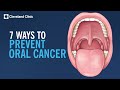 7 Ways To Prevent Oral Cancer