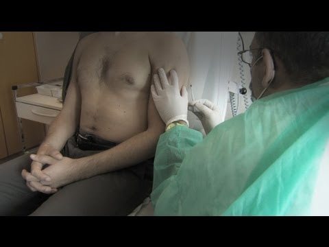 Articolazione della spalla dolore reumatoide Se osteocondrosi dare vescica