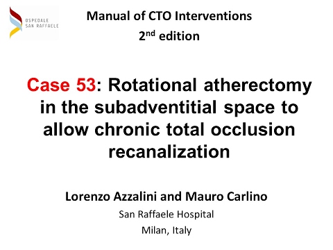 Case 53: Manual of CTO Interventions - Subadventitial Rotablator