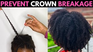What Causes Sore Scalp? | How to Prevent Breakage at the Crown | CCCA