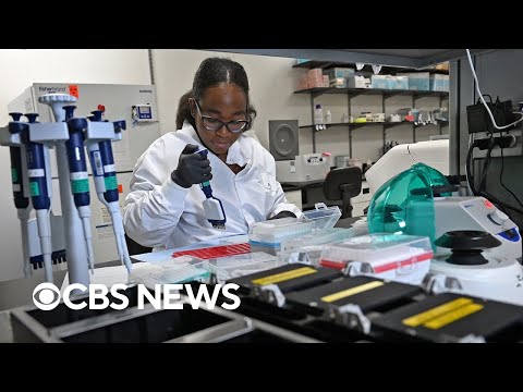 AI could help predict pancreatic cancer, study finds