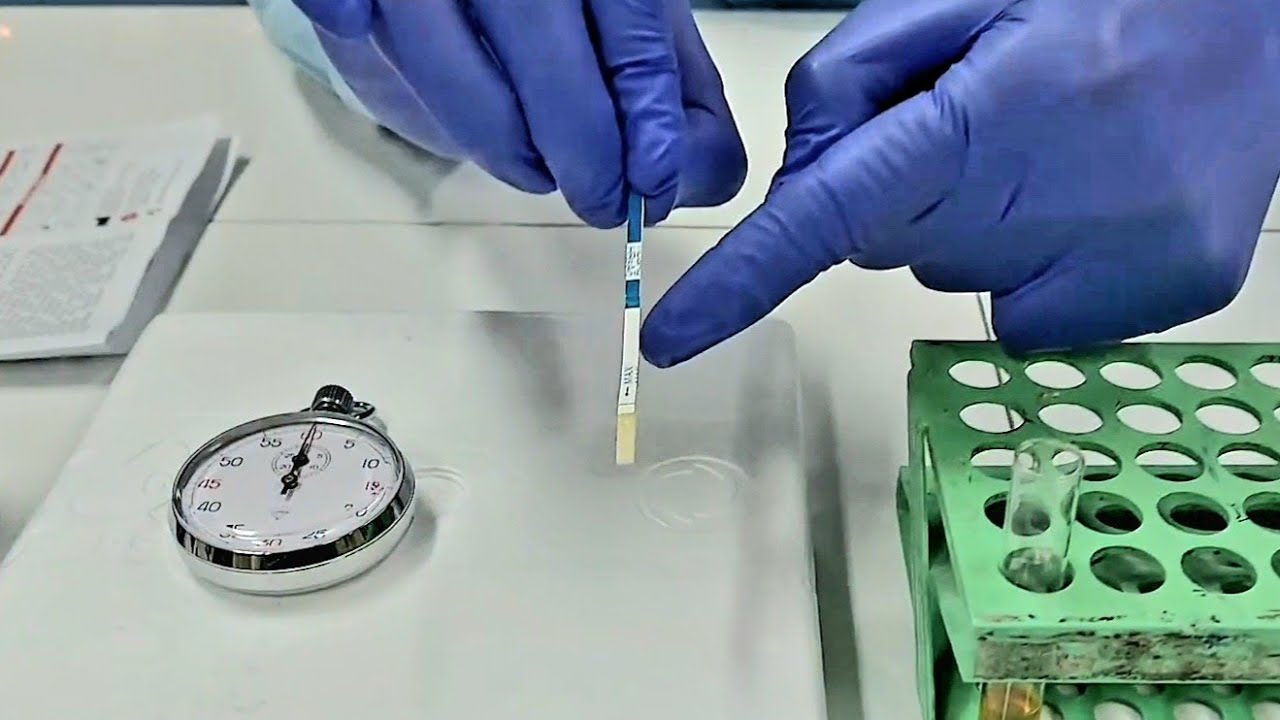 HBSAG EXAMINATION (STRIP TEST)