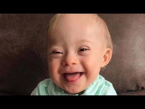 This Year's Gerber Baby Is the First With Down Syndrome