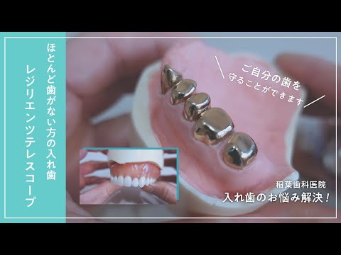 ほとんど歯がない方の入れ歯〜レジリエンツテレスコープ〜