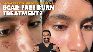 How to Treat Burns on Your Face: Plastic Surgeon Tips