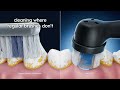 Manual Vs An IO2 Electric Toothbrush