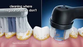 Oral-B Manual vs an iO2 Electric Toothbrush