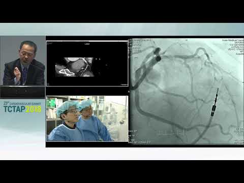 [TCTAP 2018] Master the CTO - Opening Remark & Live Case Session I