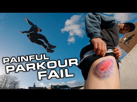 Harsh Reality of Street Parkour 🇬🇧