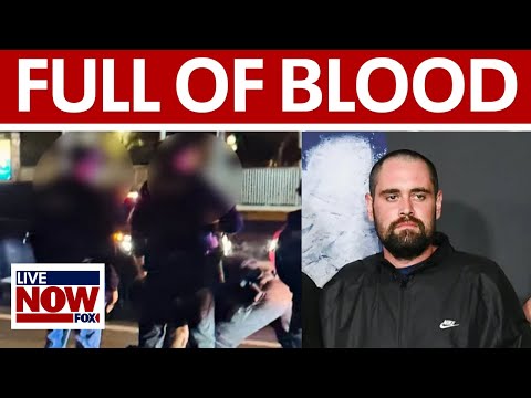 Video | Nick Reiner's hotel room reportedly "full of blood" in parents murders