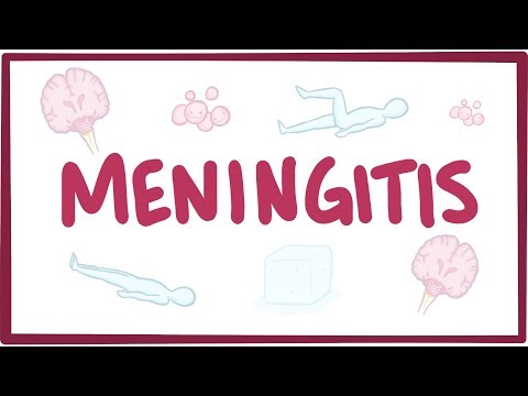 , title : 'Meningitis - causes, symptoms, diagnosis, treatment, pathology'