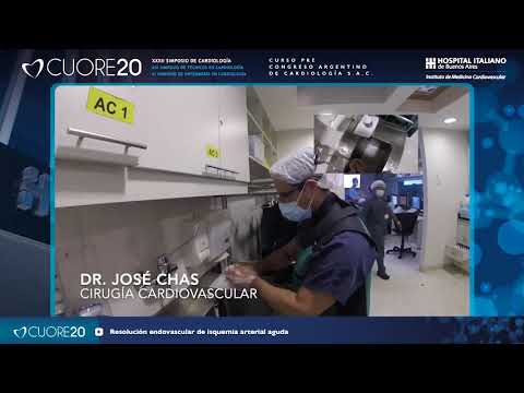 CUORE20 - Resolución endovascular de isquemia arterial aguda - Dr. Juan Valle Raleigh