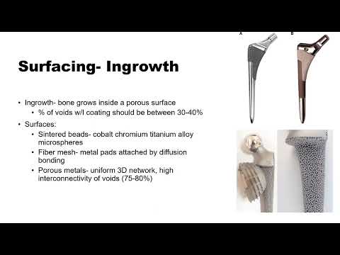 THA Femoral Design Explained w/ Dr. Anna Cohen-Rosenblum