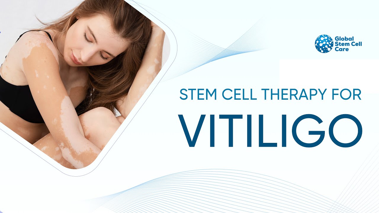 Life-Changing Stem Cell Treatment for Vitiligo | Safe &