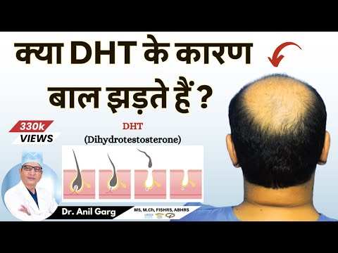 क्या DHT के कारण बाल झड़ते हैं? | Do DHT Causes Hair Loss | Dr. Anil Garg