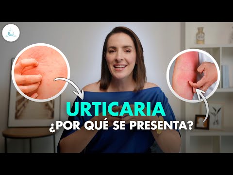 🔴 Hives | What is it? Symptoms and treatment! @drapilarochoa - Dermatologist