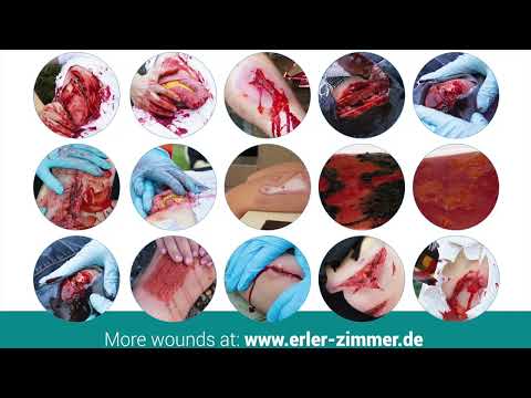 Εκπαιδευτικό Ομοίωμα Ανοιχτού Κατάγματος, Οστού του Βραχίονα με λειτουργία αιμορραγίας.  Εκπαιδευτικό Ομοίωμα Ανοιχτού Κατάγματος, Οστού του Βραχίονα με λειτουργία αιμορραγίας.