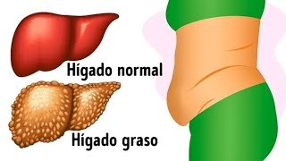 10 señales de advertencia de que tu hígado está lleno de toxinas