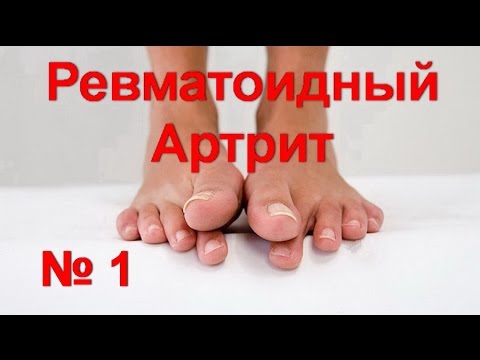 Исцеление поясницы тазобедренных суставов и ног читать Чудо рецепт от боли в суставах