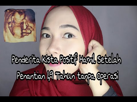 download video viral Cara Cepat Hamil Bagi Penderita Kista, download Cara Cepat Hamil Bagi Penderita Kista gratis, unduh Cara Cepat Hamil Bagi Penderita Kista