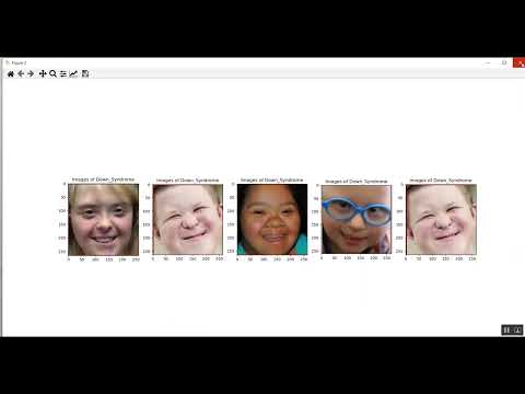 Face Disease CNN Train Streamlit App in Python Projects