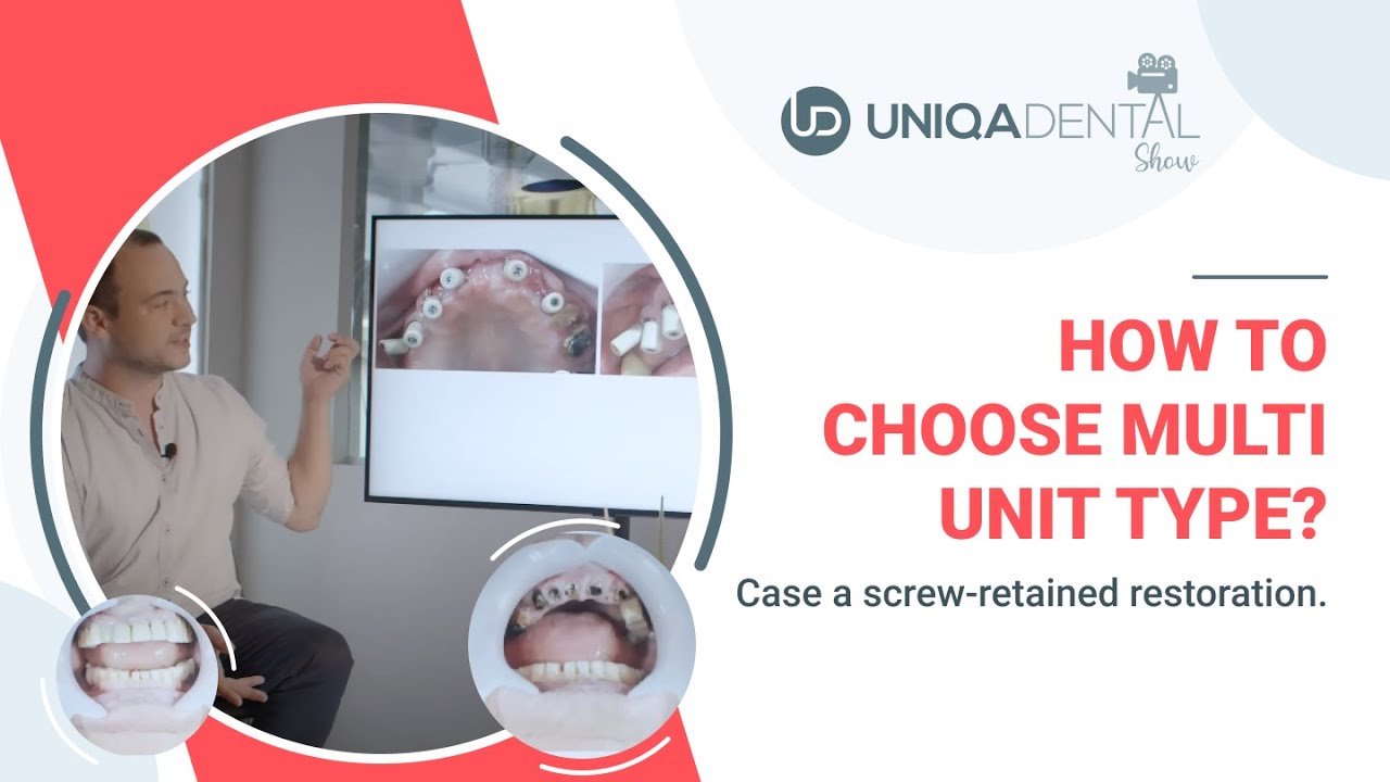 How to choose the correct Dental Multi-units MUA? Screw-retained restoration case | Oral pathology