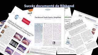 ATTELES DE CONTENTION : RIBBOND VS THE REST OF THE WORLD