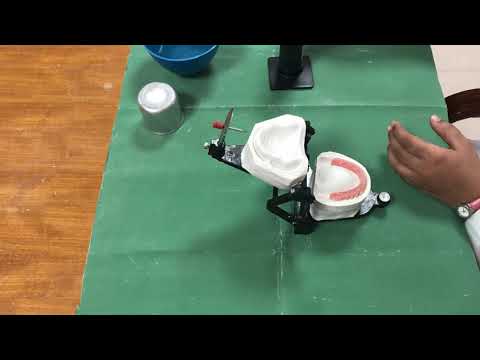 Rebasing Wax Up - PART 2