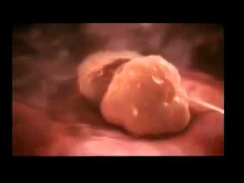 formiranje bebe u stomaku