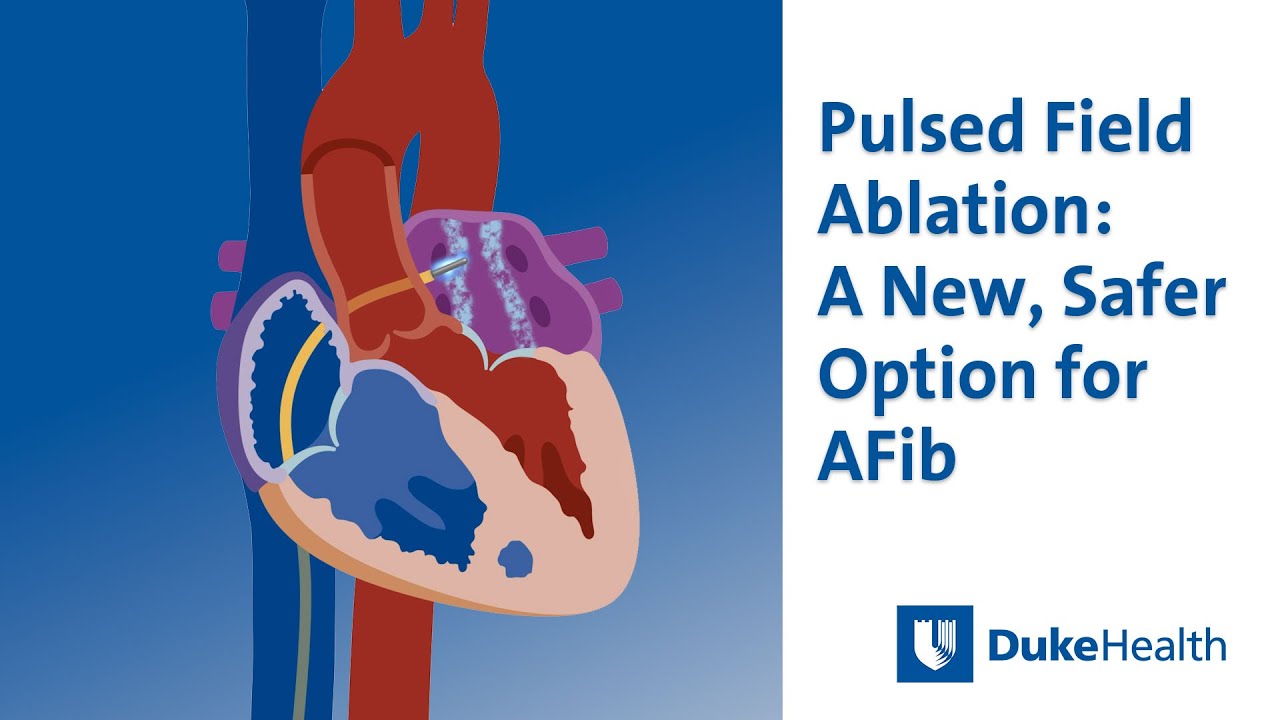 Pulsed Field Ablation (PFA): A New, Safer Option for AFib | Duke Health