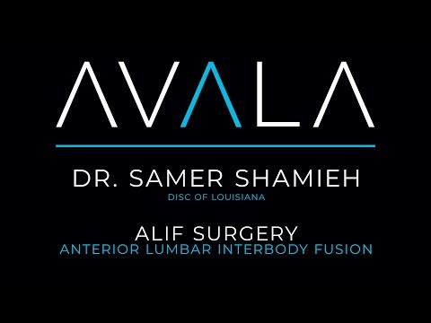 Minimally Invasive ALIF Surgery with Dr. Samer Shamieh