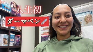 1st Derma pen experience 😬💉アメリカでダーマペン初体験