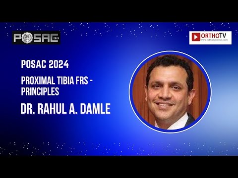 POSAC 2024 : Proximal Tibia Frs - Principles - Dr. Rahul A. Damle