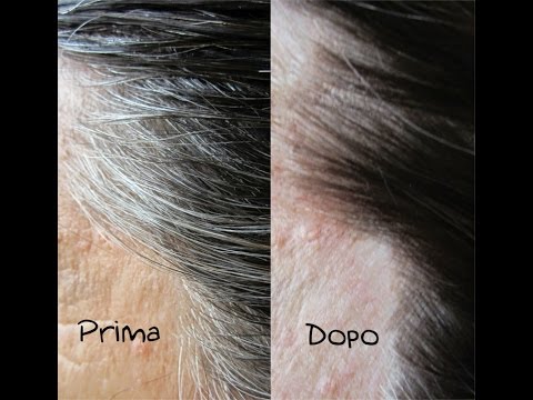 Fase doa hip Frattura del polso esercitazioni congiunte