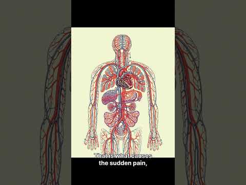 “When Calcium Goes to the Wrong Places: Understanding Pseudogout and Hidden Vascular Risk”