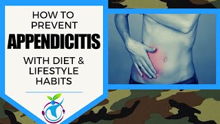 How To Prevent Appendicitis WIth Diet & Lifestyle Changes