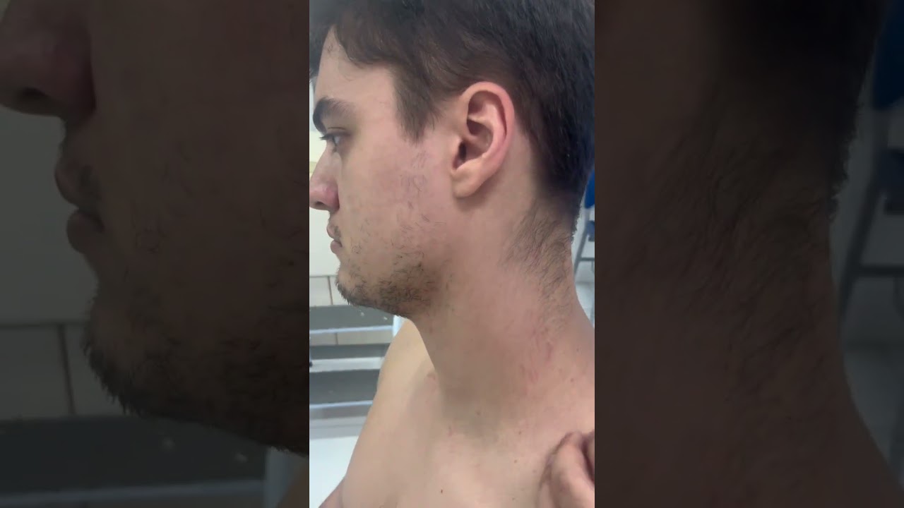 EXAME DOS LINFONODOS