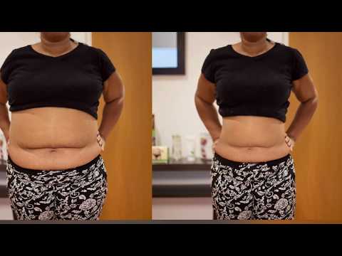 Epektibong slimming capsule slimming Slimming ehersisyo itaas na katawan