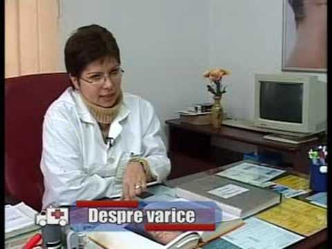 cât de scufundari ajuta la varicoza