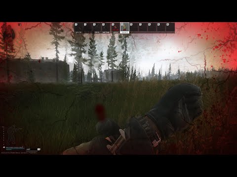 30 Health left - Escape from tarkov