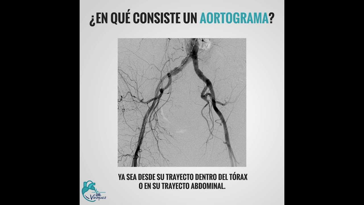 José Luis Vázquez Torres-25