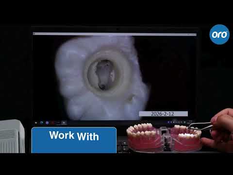 Real Footage | ORO Endo Micro Camera | HD Image & Video Quality