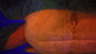 Getting Run Over by a Loggerhead